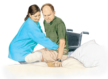 Post Operative Amputation Care